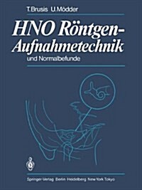 Hno Rontgen-Aufnahmetechnik Und Normalbefunde (Hardcover)