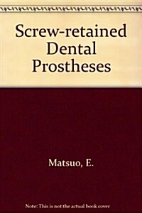 Screw Retained Dental Prostheses (Hardcover)