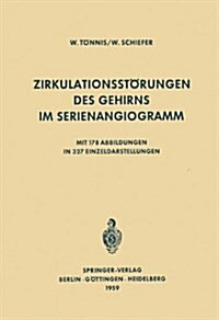 Zirkulationsstorungen Des Gehirns Im Serienangiogramm (Hardcover)