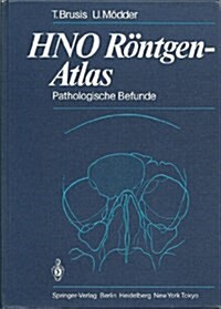 Hno Rontgen-Atlas: Pathologische Befunde (Hardcover)