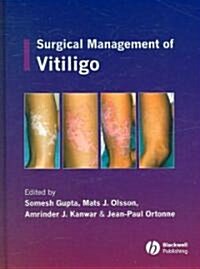 Surgical Management of Vitiligo (Hardcover)