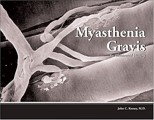 Myasthenia Gravis (Hardcover)