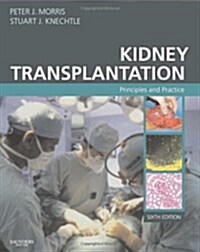 Kidney Transplantation (Hardcover, 6th)