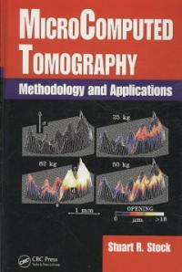 Microcomputed tomography : methodology and applications