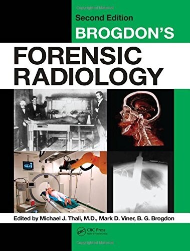 Brogdons Forensic Radiology (Hardcover, 2)