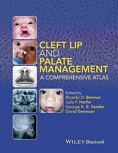Cleft Lip and Palate Management: A Comprehensive Atlas (Hardcover)