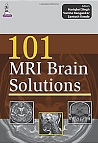 101 MRI Brain Solutions (Paperback, UK)