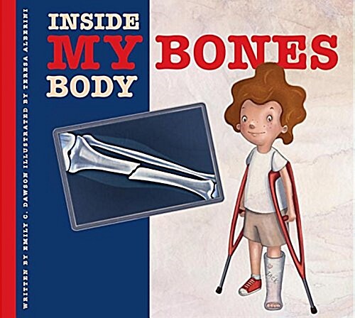 My Bones (Library Binding)