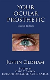 Your Ocular Prosthetic (Paperback)