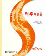 척추측만증=Scoliosis