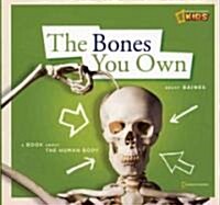Zigzag: The Bones You Own (Library Binding)