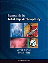 Essentials in Total Hip Arthroplasty (Hardcover, New)