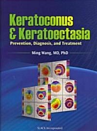 Keratoconus & Keratoectasia: Prevention, Diagnosis, and Treatment (Hardcover)