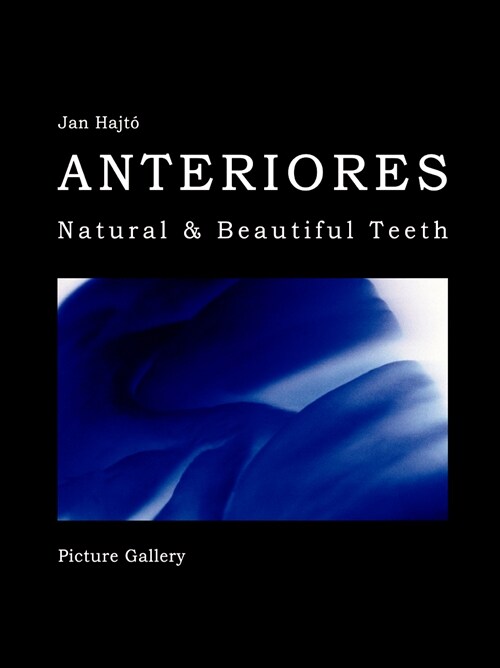 Anteriores-Natural & Beautiful Teeth-Picture Gallery