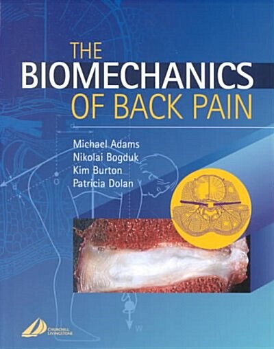 The Biomechanics of Back Pain (Hardcover)