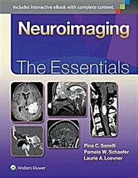 Neuroimaging: The Essentials (Hardcover)