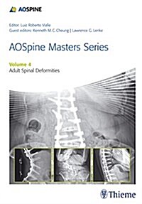 Aospine Master Series, Vol. 4: Adult Spinal Deformities (Hardcover)