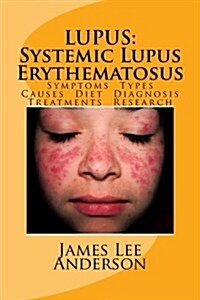 Lupus Systemic Lupus Erythematosus (Paperback)