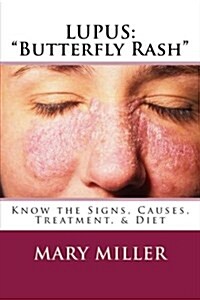 Lupus Butterfly Rash (Paperback)