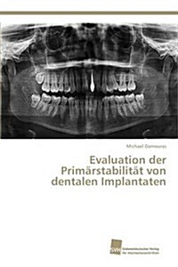 Evaluation der Prim?stabilit? von dentalen Implantaten (Paperback)