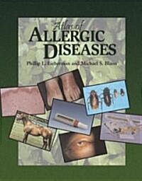 Atlas of Allergic Diseases (Hardcover)