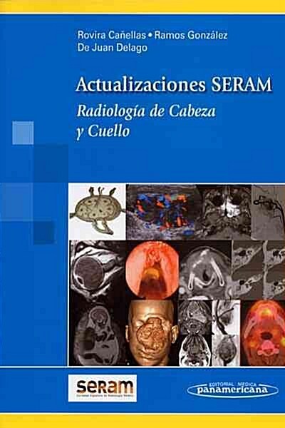 Radiologia De Cabeza Y Cuello / Head and Neck Radiology (Paperback, 1st)