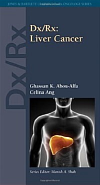 DX/Rx: Liver Cancer: Liver Cancer (Paperback)
