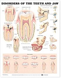 Disorders of the Teeth and Jaw Anatomical Chart (Other)