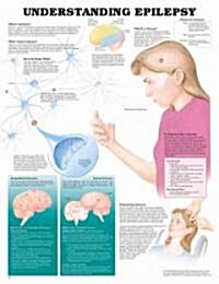 Understanding Epilepsy Anatomical Chart (Chart, Wall)