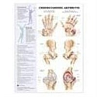 Understanding Arthritis Anatomical Chart (Chart, Wall)