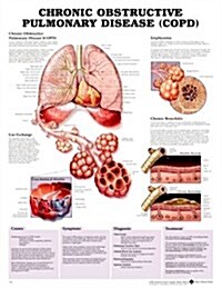 Chronic Obstructive Pulmonary Disease (COPD) Anatomical Chart (Chart, Wall)