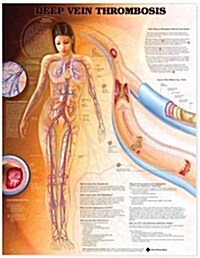 Deep Vein Thrombosis Anatomical Chart (Other)