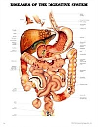 Diseases of the Digestive System Anatomical Chart (Chart, 1st, Wall)