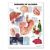 Dangers of Alcohol Anatomical Chart (Chart, Wall)