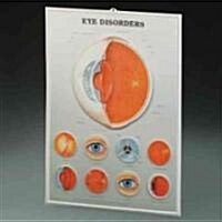 Eye Disorders (Chart, Wall)