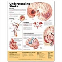 Understanding Stroke Anatomical Chart (Other, 2)