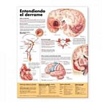 Entendiendo Que Es Un Derrame/Understanding Stroke Anatomical Chart (Chart, 1st, LAM)