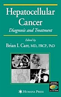 Hepatocellular Cancer (Hardcover, CD-ROM)