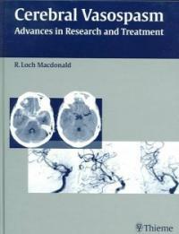 Cerebral vasospasm : advances in research and treatment