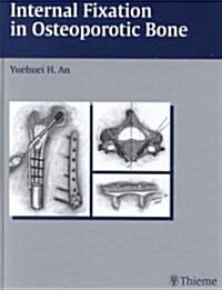 Internal Fixation in Osteoporotic Bone (Hardcover, New)
