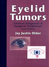 Eyelid Tumors: Clinical Diagnosis and Surgical Treatment (Hardcover, 2)