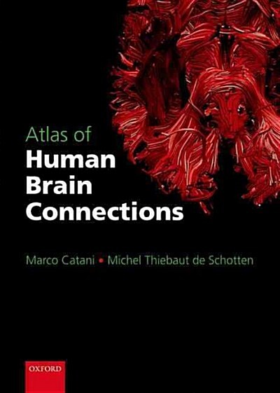 Atlas of Human Brain Connections (Paperback)