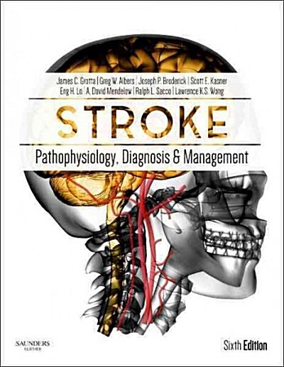 Stroke: Pathophysiology, Diagnosis, and Management (Hardcover, 6, UK)