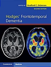 Hodges Frontotemporal Dementia (Hardcover, 2 Revised edition)