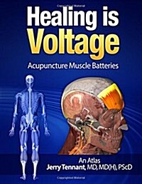 Healing Is Voltage: Acupuncture Muscle Batteries (Paperback)