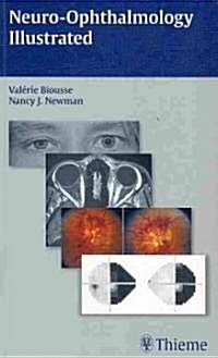 Neuro-Ophthalmology Illustrated (Paperback, 1st)