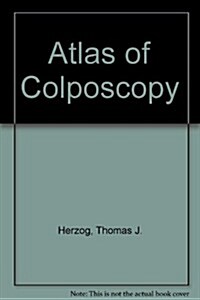 Atlas of Colposcopy (Hardcover)