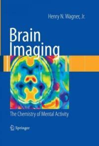 Brain imaging : the chemistry of mental activity