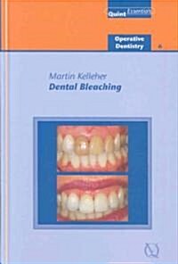 Dental Bleaching (Hardcover, 1st)