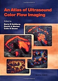 Atlas of Ultrasound Color Flow Imaging (Hardcover)